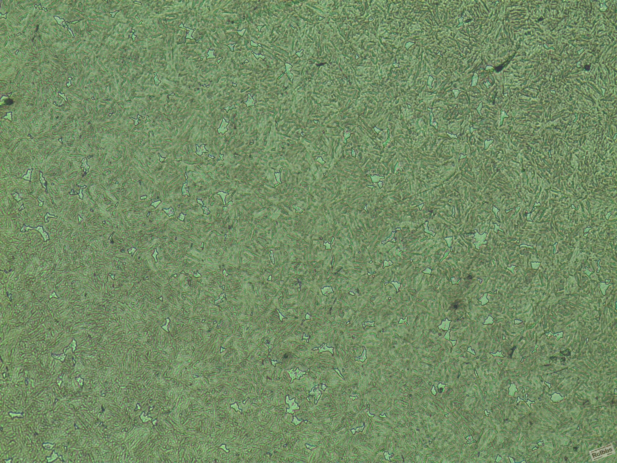 20CrMnTi心部-400X