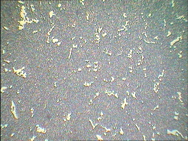 200x