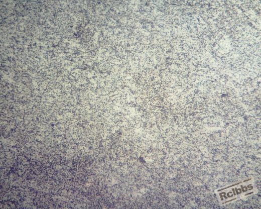 横向原材料400倍 (3) (520x416).jpg
