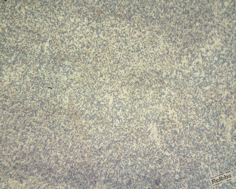 PH13锻件400倍1硝酸 (800x640).jpg