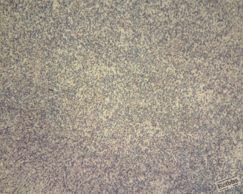PH13锻件400倍2硝酸 (800x640).jpg