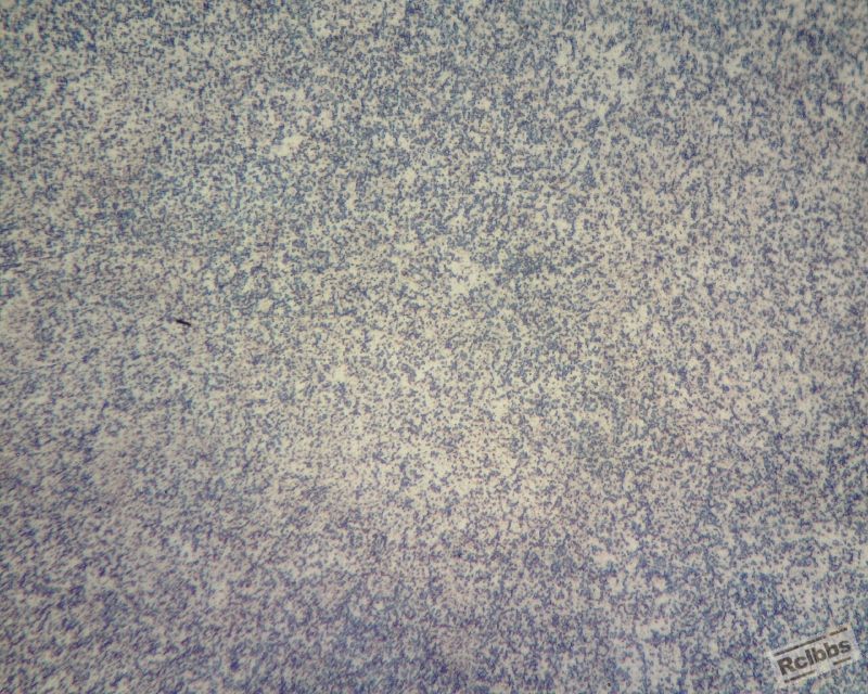 PH13锻件400倍3硝酸 (800x640).jpg
