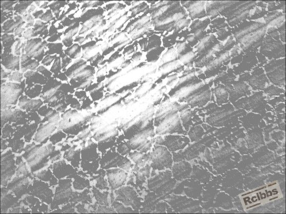 晶粒度 100X锻造后.jpg