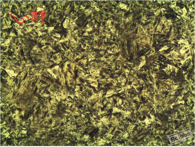 1心部组织（是齿）