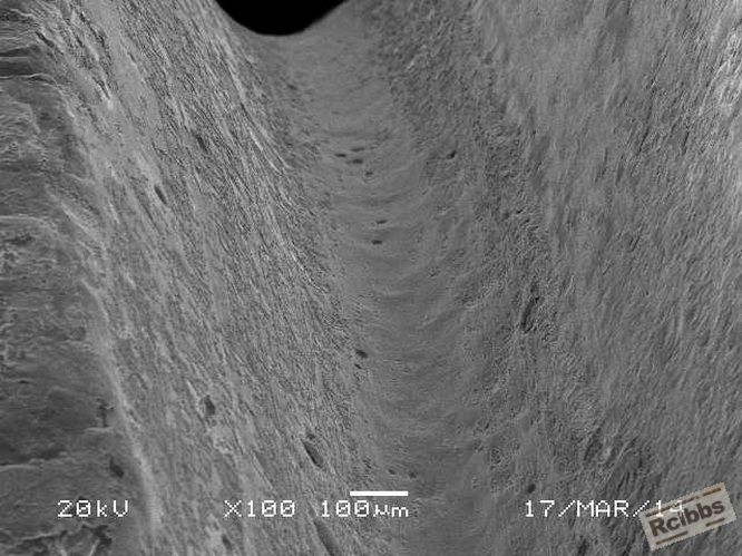 root surface flawless