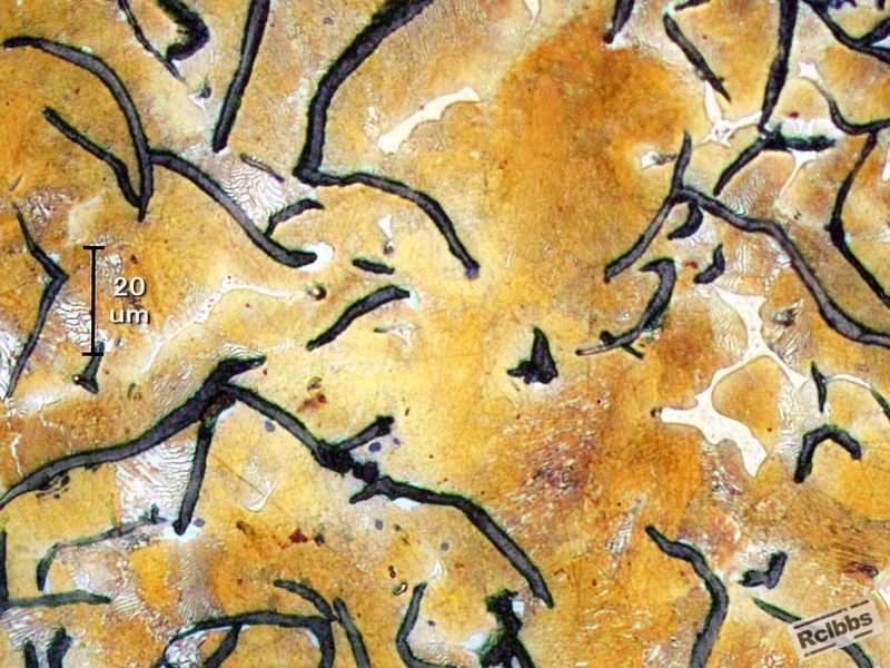 Steadite in gray iron