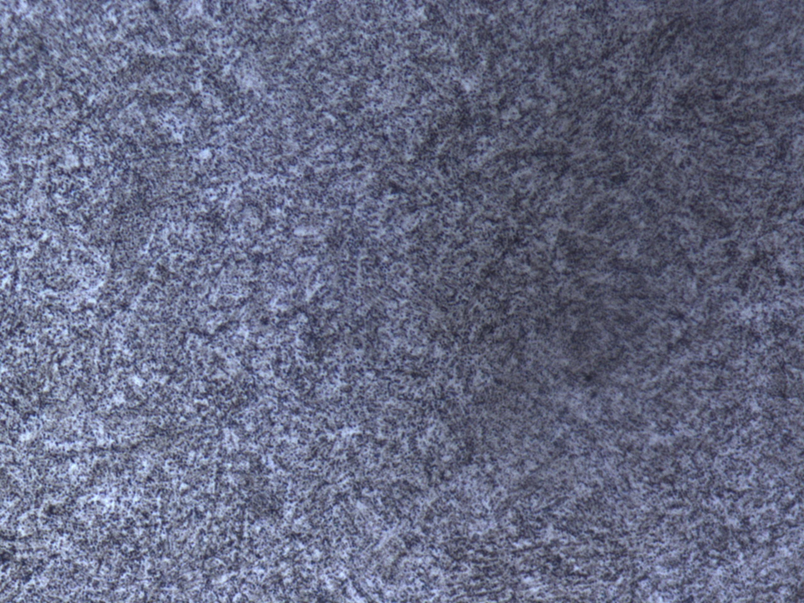 1000倍浅腐蚀