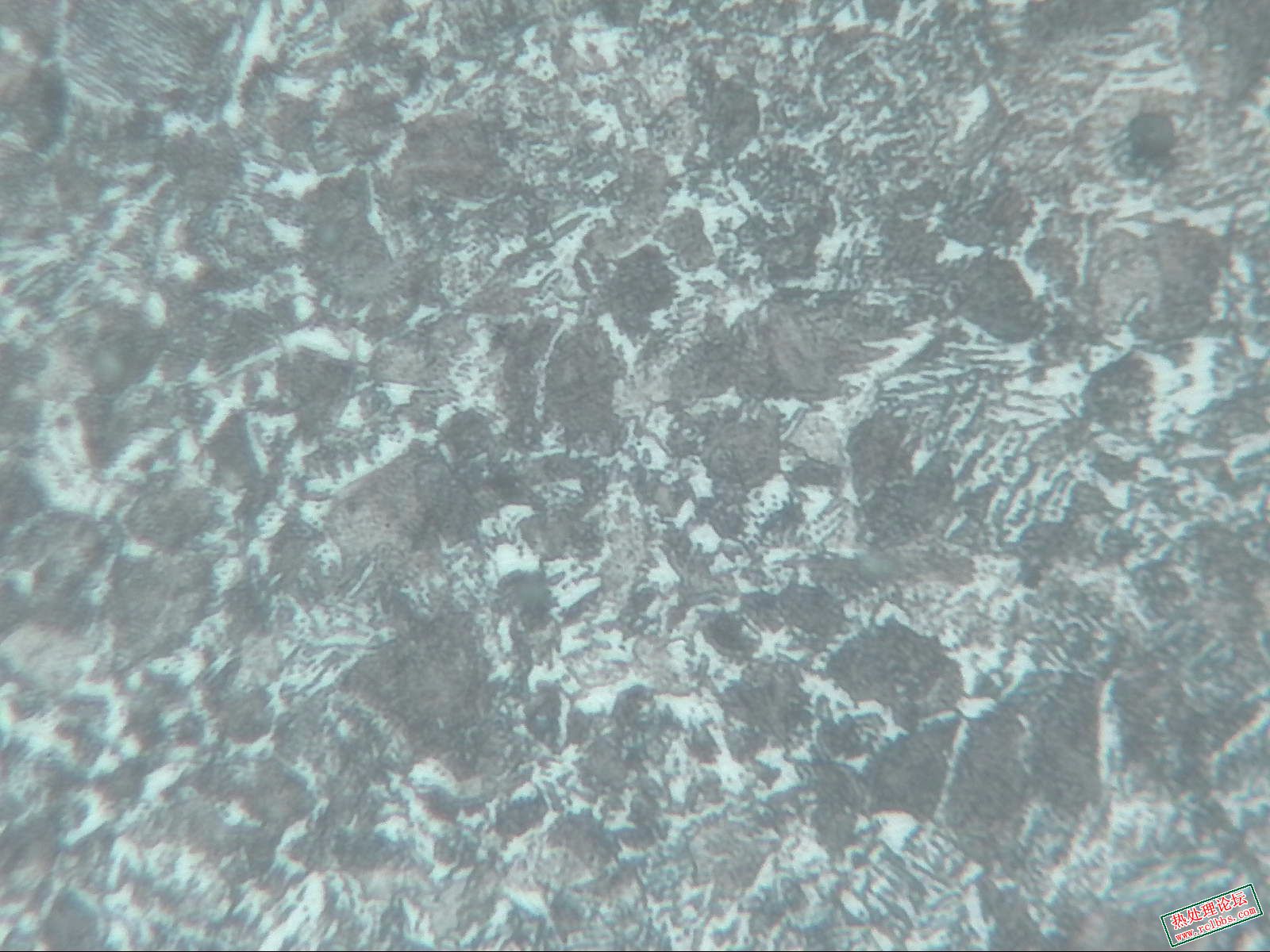 切片中频异常区-400X-1.jpg