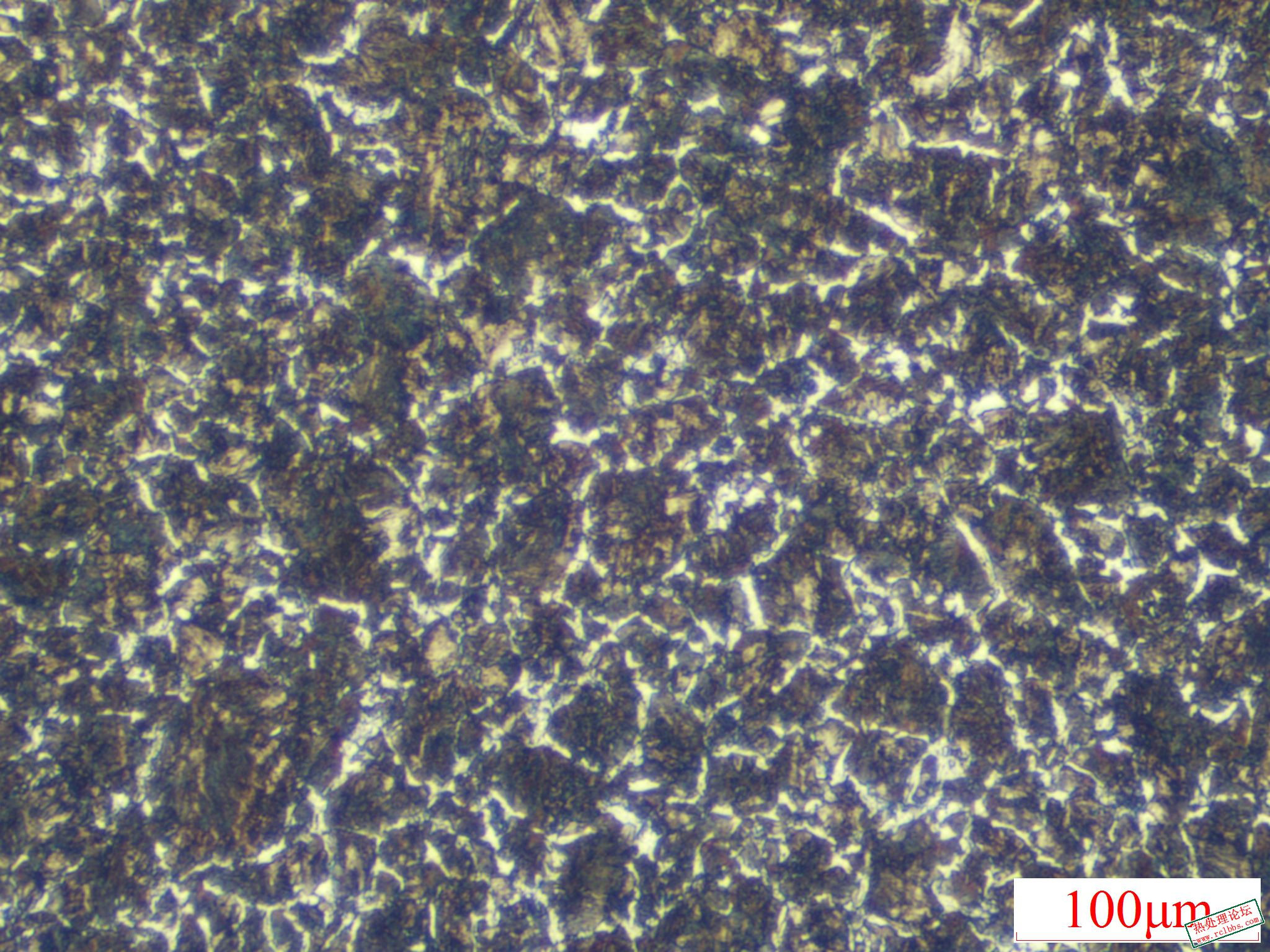 002心部组织 100X-3.JPG