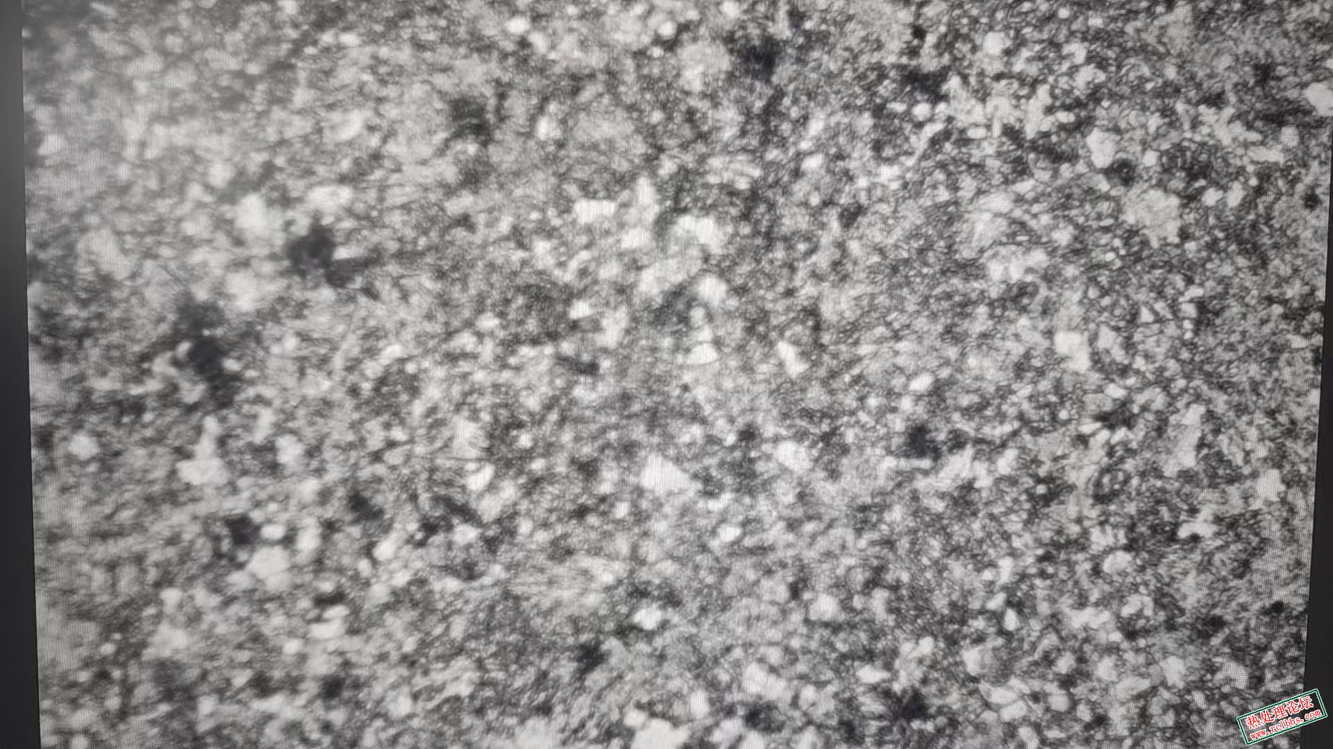 图片中黑色的圆点是什么组织？