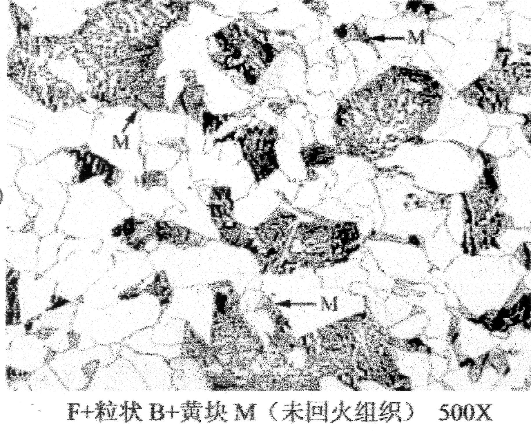 黄块马氏体2.jpg