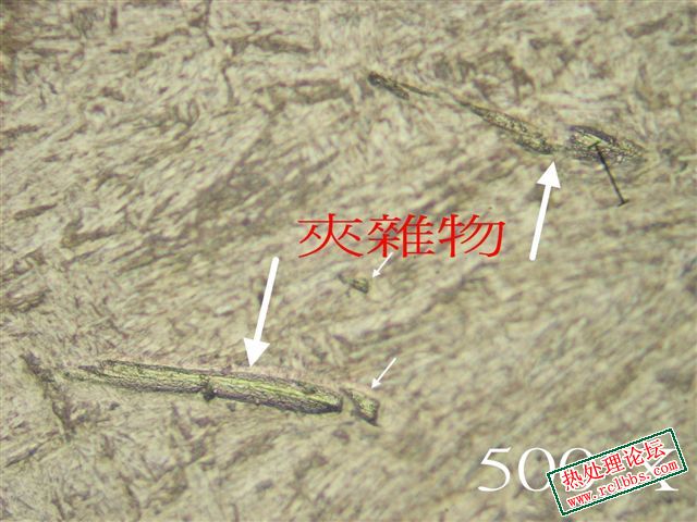 介在物.jpg