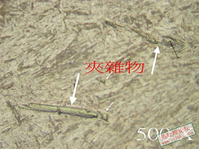 介在物.jpg