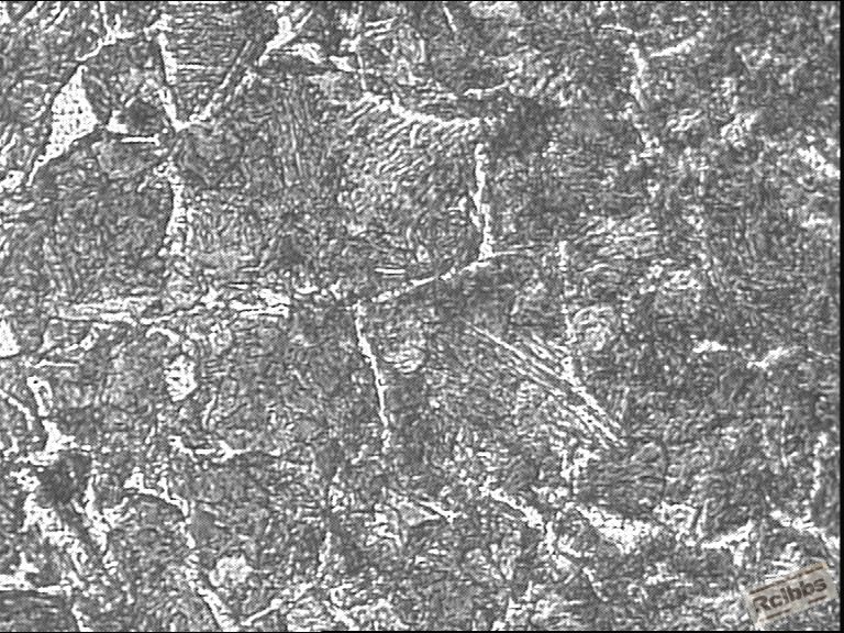 过渡区组织400X