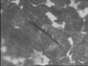 不正常组织-500x-2.jpg