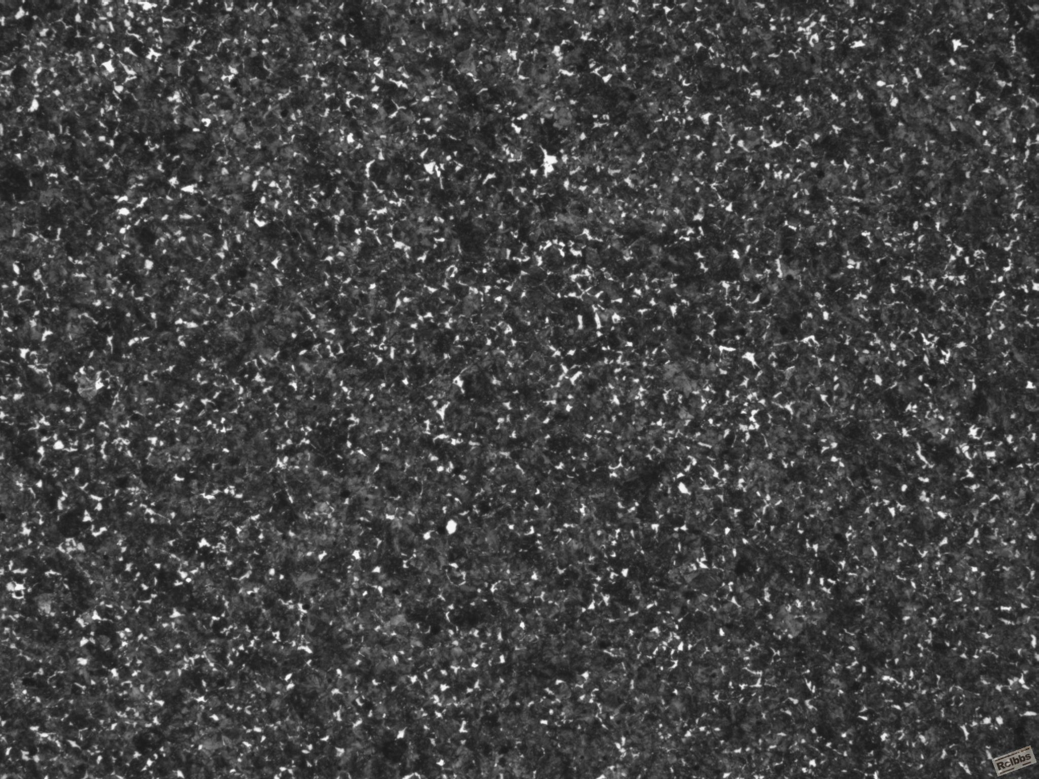 C9090666-1组织(黑白)-100X.JPG