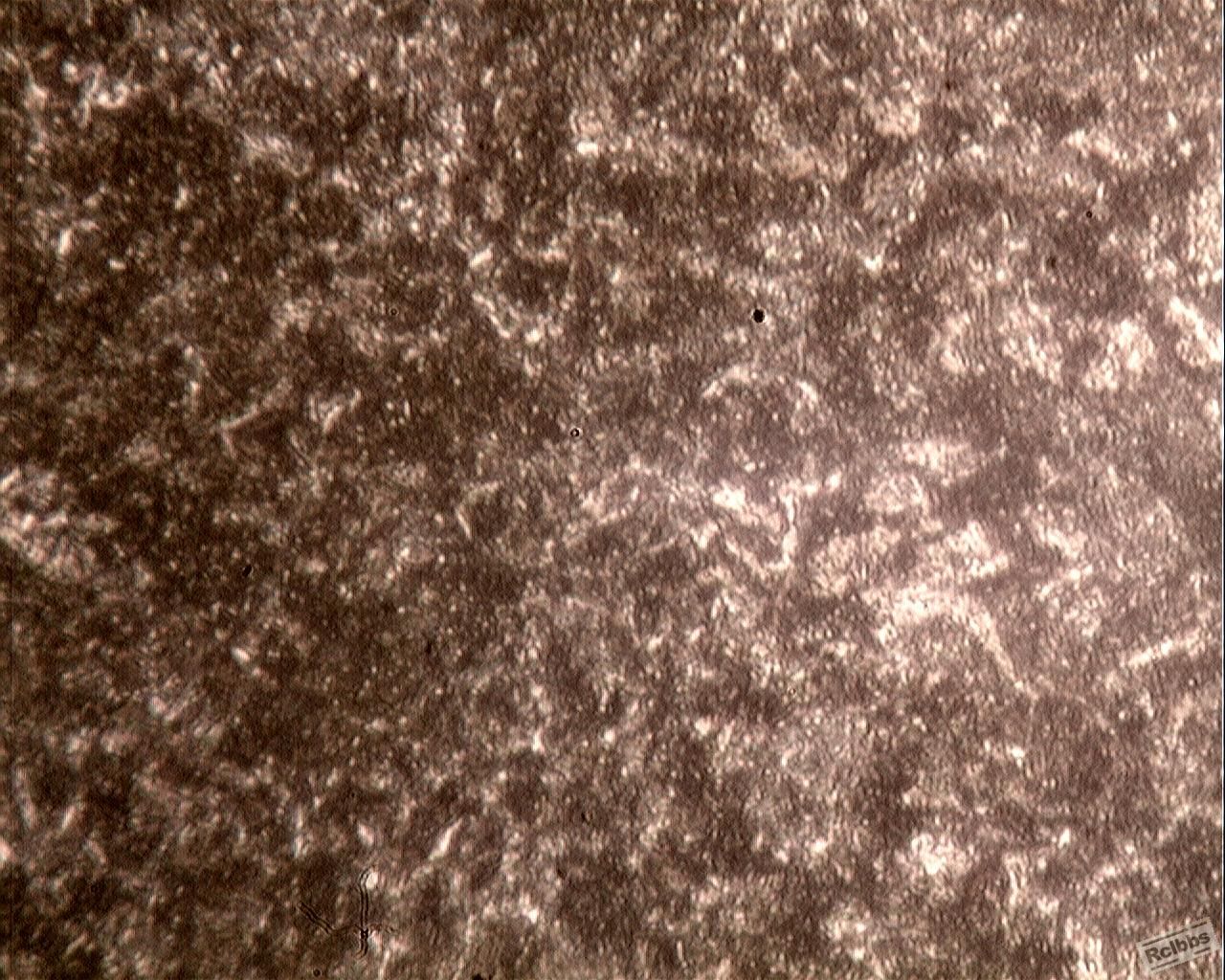 表面剥落轧辊边缘过渡层组织形貌  630X