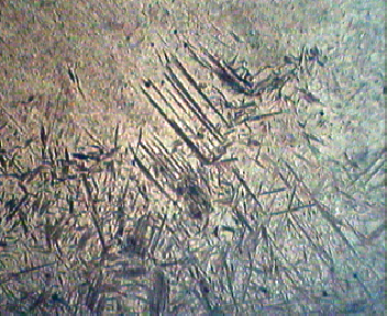 过渡区100X.jpg