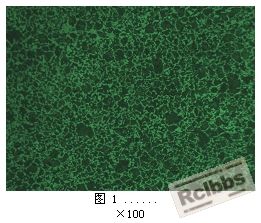 45正火100X.JPG