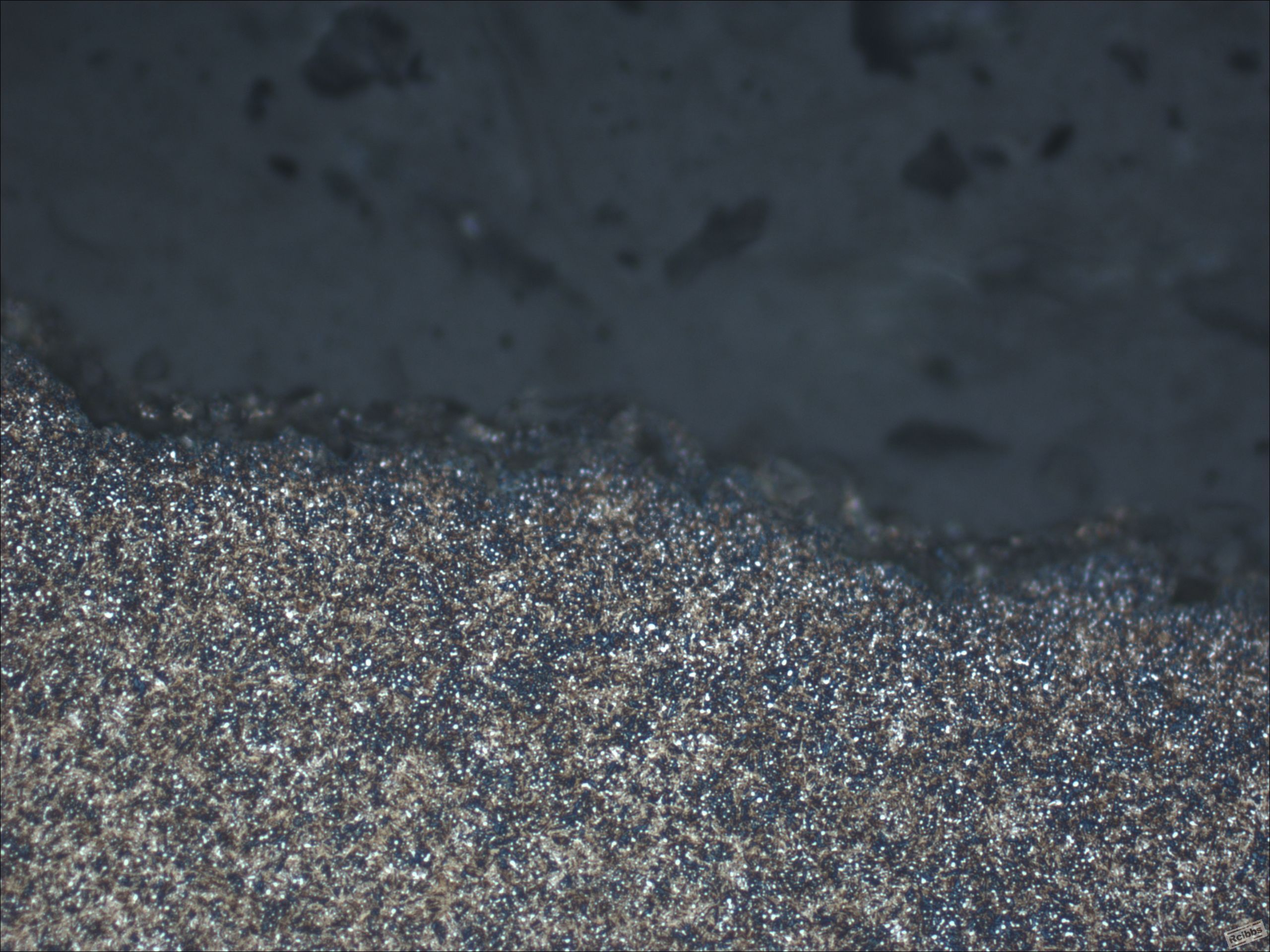 fracture-500x.JPG