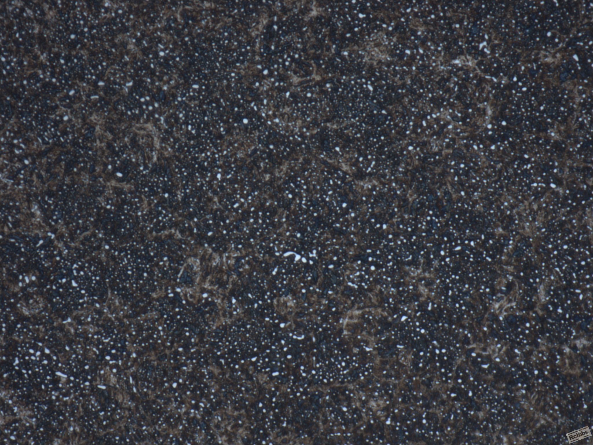 未标题-2，100×正常金属.jpg