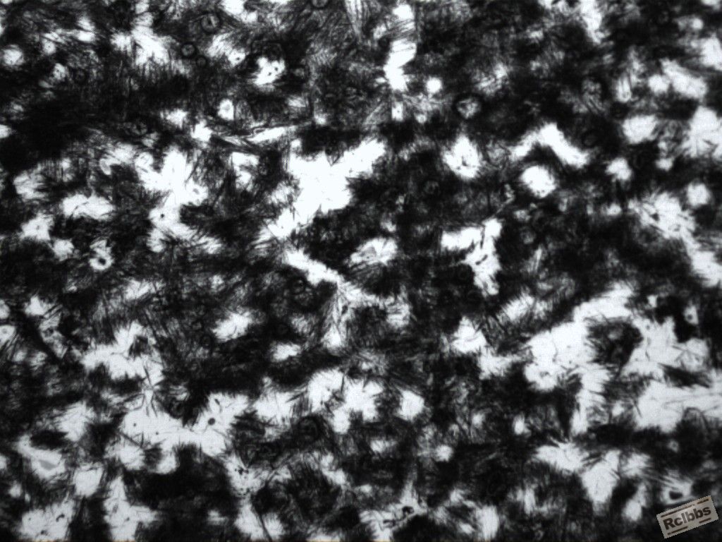 200X
