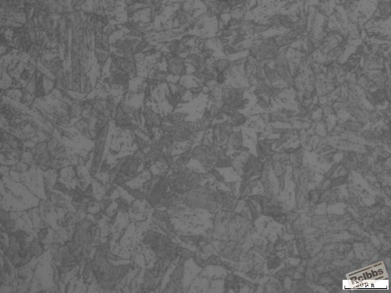 11H3066 组织 500X  P91.JPG